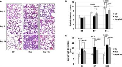 Celecoxib Protects Hyperoxia-Induced Lung Injury via NF-κB and AQP1